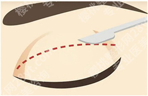 北京联合丽格医疗美容修复双眼皮价格,医院细节曝光