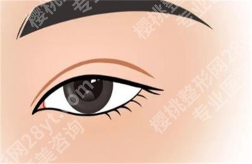 九院刘菲割双眼皮好吗?医生实力介绍,一文参考