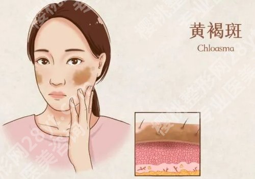 九院马刚怎么样知乎?附医生个人信息及实力测评