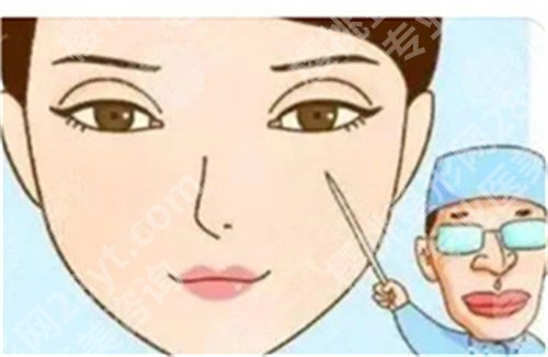北京张冰洁修复怎么样?附双眼皮失败案例