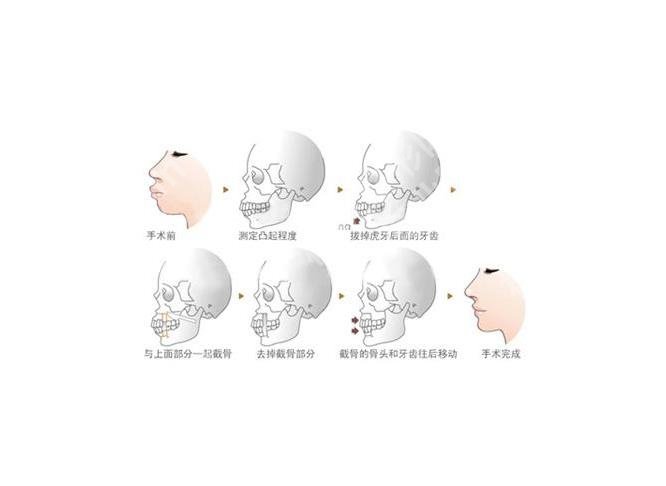 上海正颌医生高伟怎么样?个人简介\出诊医院\正颌案例