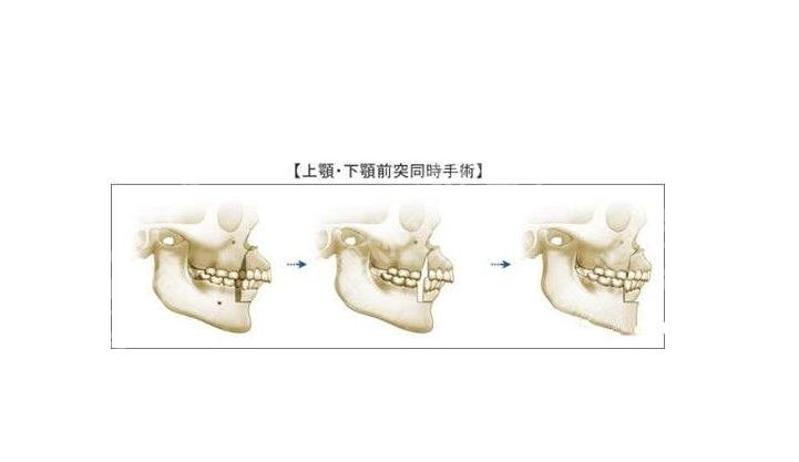 上海正颌医生高伟怎么样?个人简介\出诊医院\正颌案例