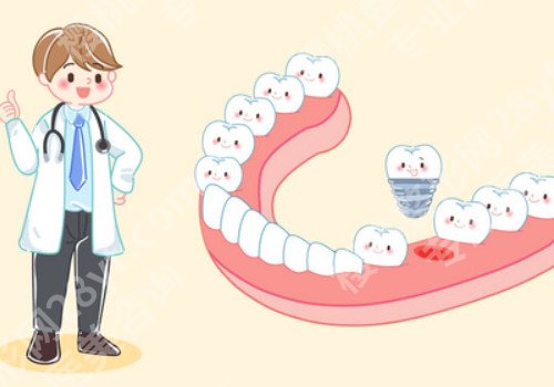 大连种植牙案例分享，操作过程要配合好医生！
