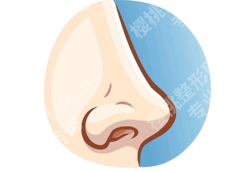 郑州肋骨鼻子大概多少钱?手术难度怎么样?