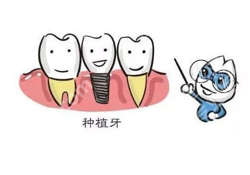无锡种植牙案例,手术过程相关情况分享!