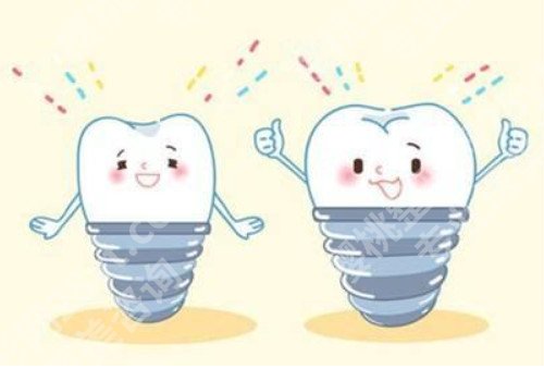 种植牙齿的寿命多少年？种植材料有什么？