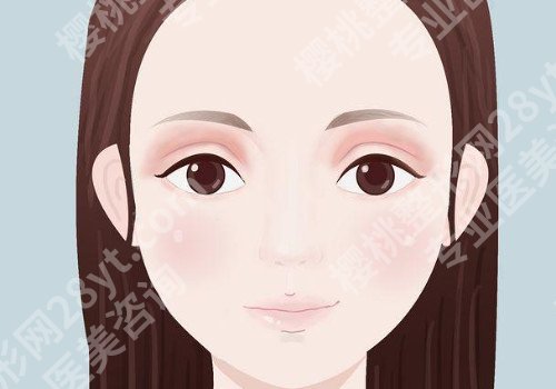 埋线双眼皮可以保持几年?做埋线双眼皮后多久可以恢复?