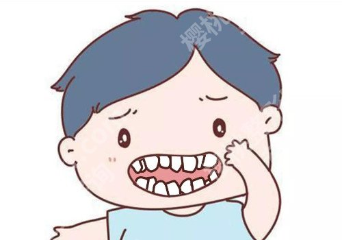 地包天矫正需要多长时间?带你了解手术全过程及注意事项!