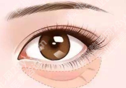 去鱼尾纹一般的价格?多家医院介绍!一起看看吧!