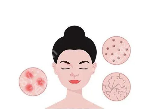 教你9种缩小毛孔方法?应如何护理!