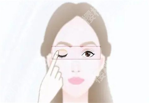 激光洗眉2次干净的图片,真人案例反馈了