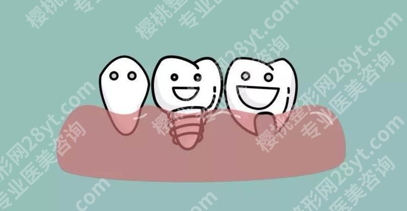 北京崇文口腔医院种牙好吗？医院口碑评价|种牙效果图预览！