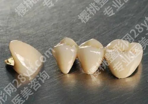 北京圣贝口腔牙齿矫正价格表公布！附医院特色项目介绍