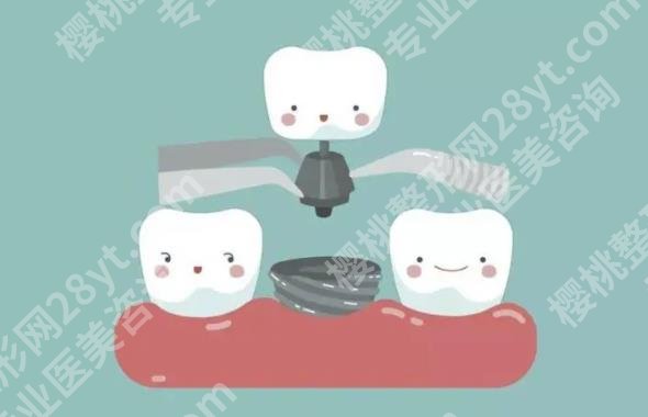 上海第十人民医院种植牙怎么样？院内口碑医生介绍！种植牙案例
