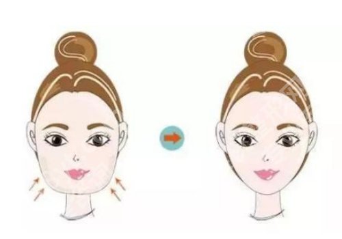 北京画美医疗美容医院好不好?答案分析详细来袭