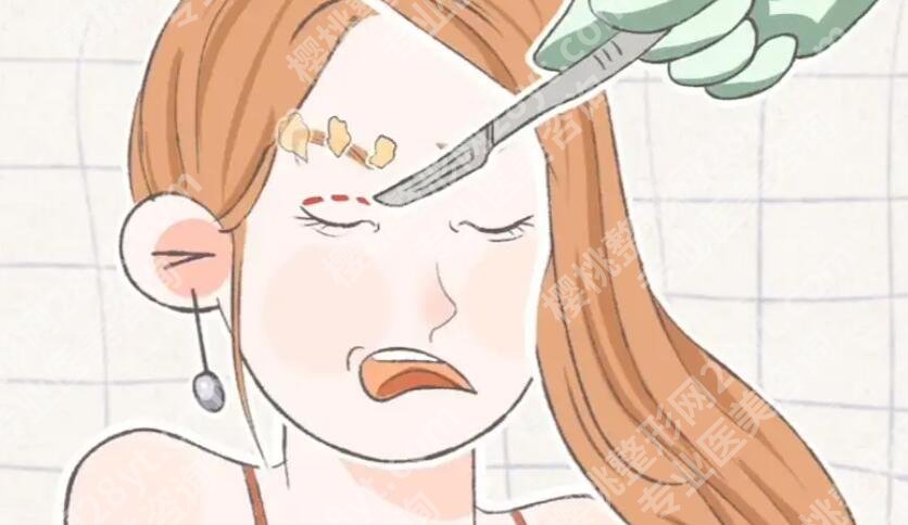 泉州第一医院割双眼皮技术好不好?医院简介|真人案例分享!