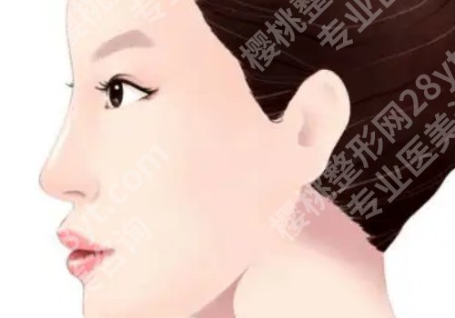 九院谢峰隆鼻案例图来袭!内附医生信息介绍!