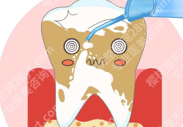 合肥滨湖医院牙科洗牙多少钱?院内口碑医生推荐!洗牙案例
