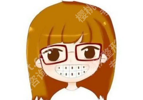 北京诺美口腔牙齿矫正费用是多少?顾客点评及案例鉴赏!