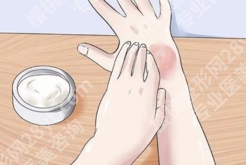 上海欧莱美可以去疤痕吗?哪位医生的技术比较好?用户口碑分享!