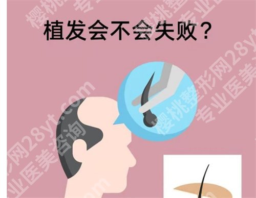 天津三甲医院可以植发吗?专业技术一览,好评如潮
