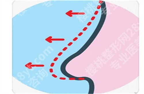重医大附一院双眼皮价格怎么样?项目在线了解,科室大盘点