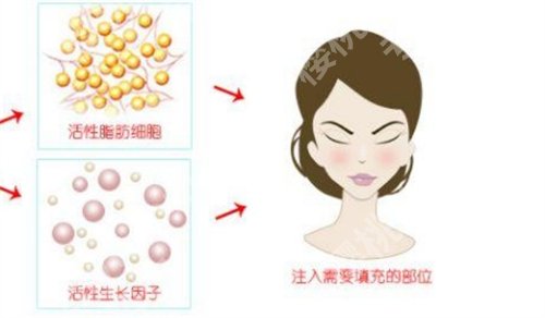 成都华西医院可以丰胸吗?特色项目推荐,技术优势公布