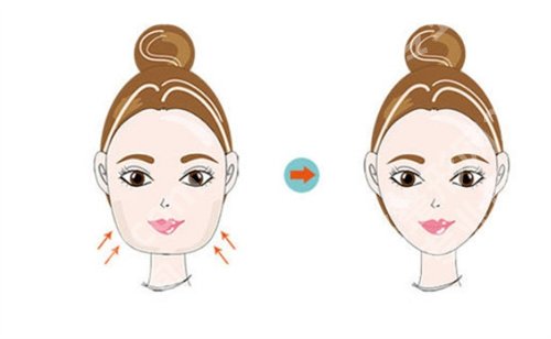 吉大医院美容科怎么样?手术科普问答,项目优势介绍