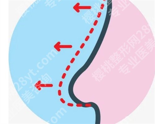 北京艺星连凯峰做鼻子怎么样?口碑点评新鲜出炉,公布特色