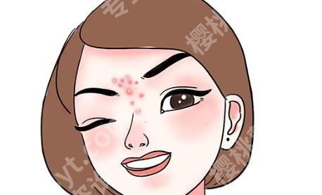 湘潭中心医院美容科祛痘的技术好不好?医院详细资料介绍!