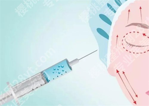 北京画美注射技术怎么样?项目云集,抓紧时间收藏