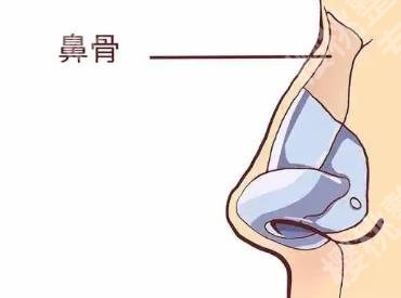 北京八大处医疗美容医院双眼皮修复怎么样?真实案例|见证TA的蜕变
