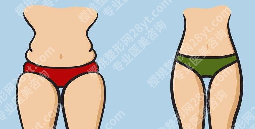 北京八大处吸脂价格表|院内医生实操案例及网友体验感反馈