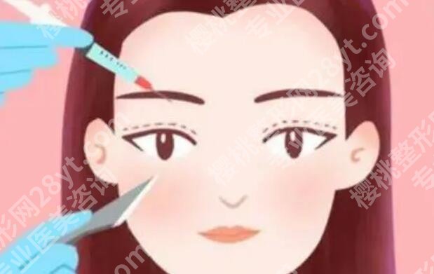 邵春益医生好嘛?做双眼皮技术靠谱吗?来看详细介绍!