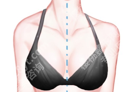 105医院整形美容科好吗?真实口碑点评信息来袭!