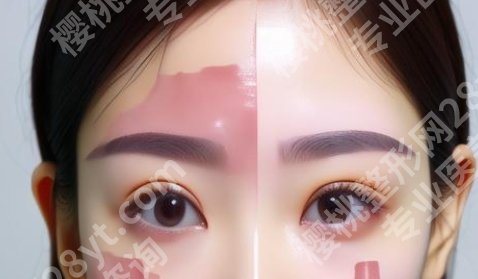 西南医院整形美容科价格贵不贵?真实案例|来见证TA的蜕变!