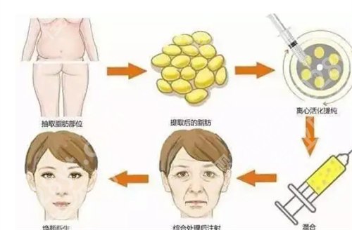 湖南省人民医院整形美容科哪个医生更好?医生列表来了,速来
