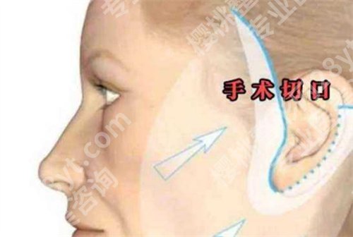 中山一院美容科怎么样?价格表在线查看,做好术前攻略