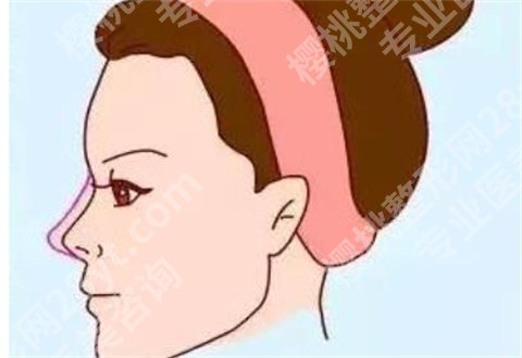 张明兴医生做鼻修复技术怎么样?坐诊医院安排集美了解