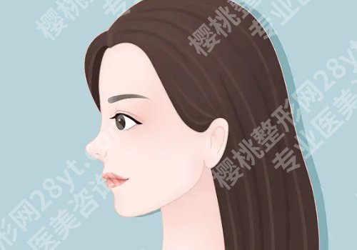 上海范荣杰做鼻子好不好?经典案例更新啦!