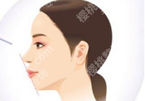 重庆有资质做颌面整形的医院是哪家?口碑医院名单上榜