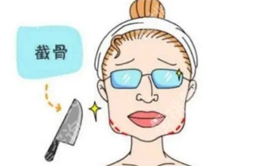 黄大勇做磨骨手术怎么样?网友体验感反馈,口碑不错哦