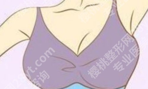 刘春军做胸部手术特点怎么样?医生基本信息与网友真实反馈