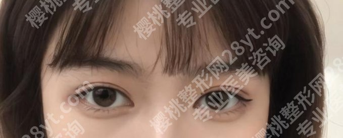 玉林华美医疗美容医院有开展那些项目?真实的案例鉴赏!