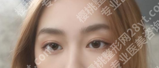 中美瑞辰整形医院在哪里?医院地理位置及变美常见问题你解答!