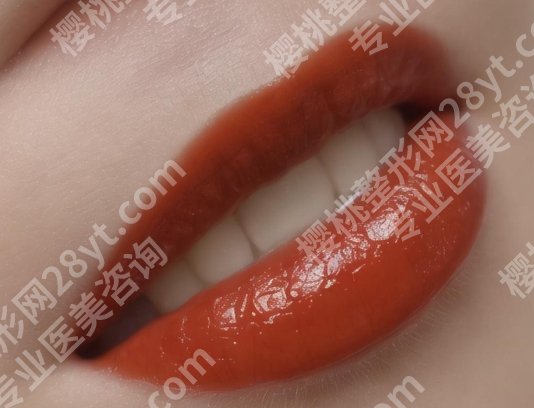 蚌埠美莱坞整形医院纹唇怎么样?医院口碑点评及案例鉴赏!