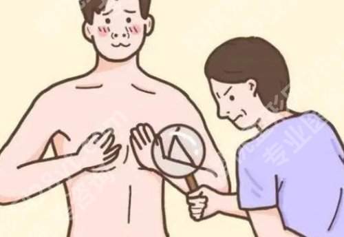 毕晔医生做男性乳房肥大手术多少钱?医生实力测评|一键查看网友反馈