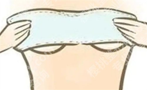裴柄万做鼻子怎么样?医生简介公布|真人案例介绍