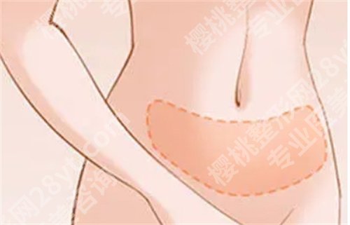 北京协和医院王阳抽脂价格贵吗?医生好评不断|案例详情曝光