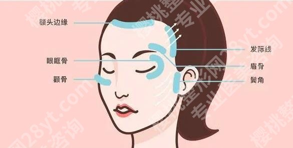 刘填充技术怎么样?坐诊医院是哪家?面部填充费用